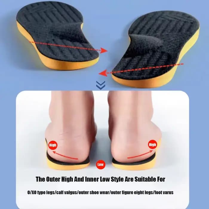 Semelles orthopédiques pour pieds plats pour hommes et femmes, chaussures de soutien de la voûte plantaire pour enfants, Type X/O, jambes, genouillères, Correction Varus