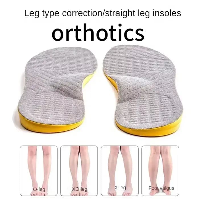 Semelles orthopédiques pour pieds plats pour hommes et femmes, chaussures de soutien de la voûte plantaire pour enfants, Type X/O, jambes, genouillères, Correction Varus